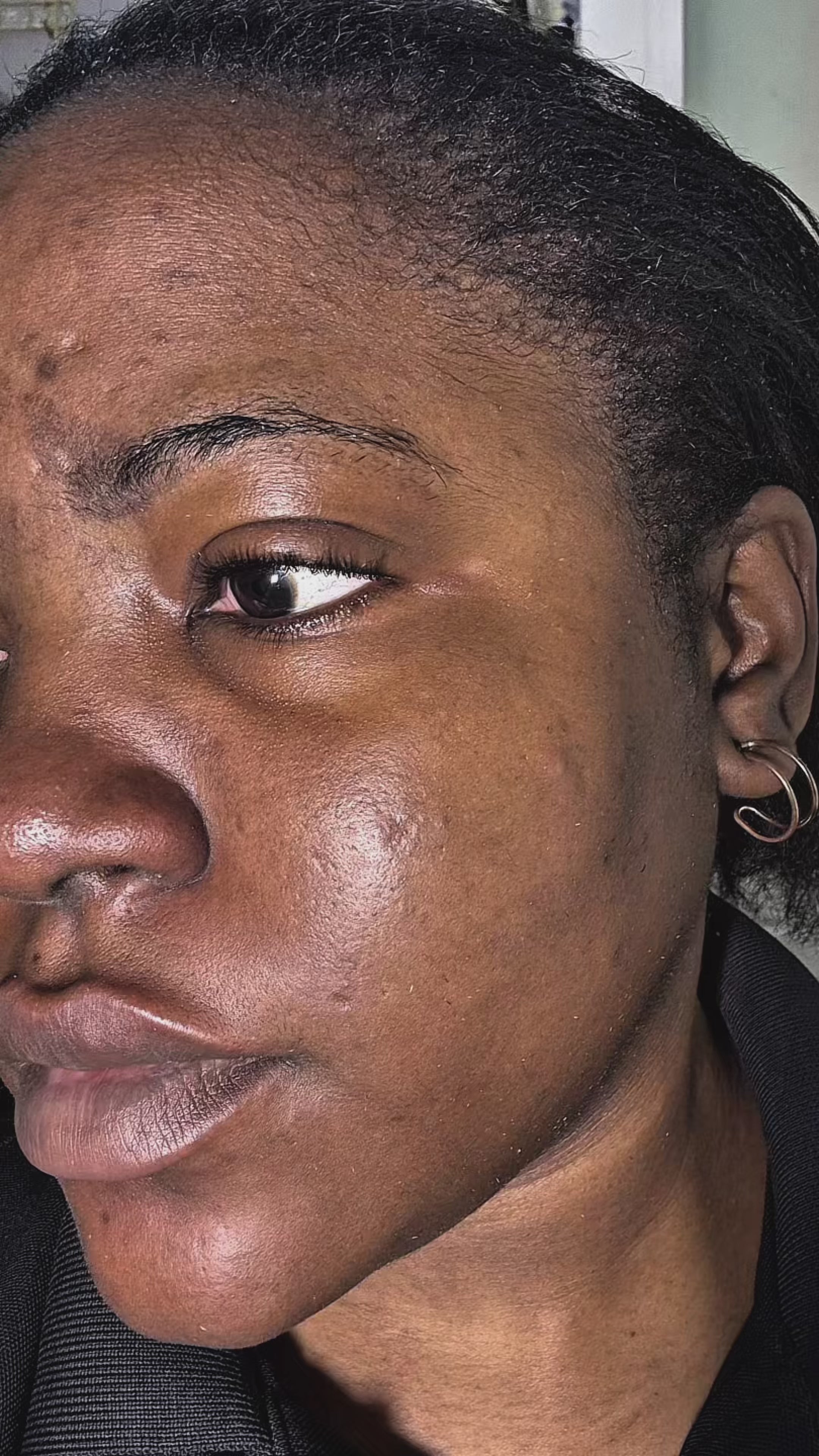 Load video: Testimonial from a client on the progress of her treatment.