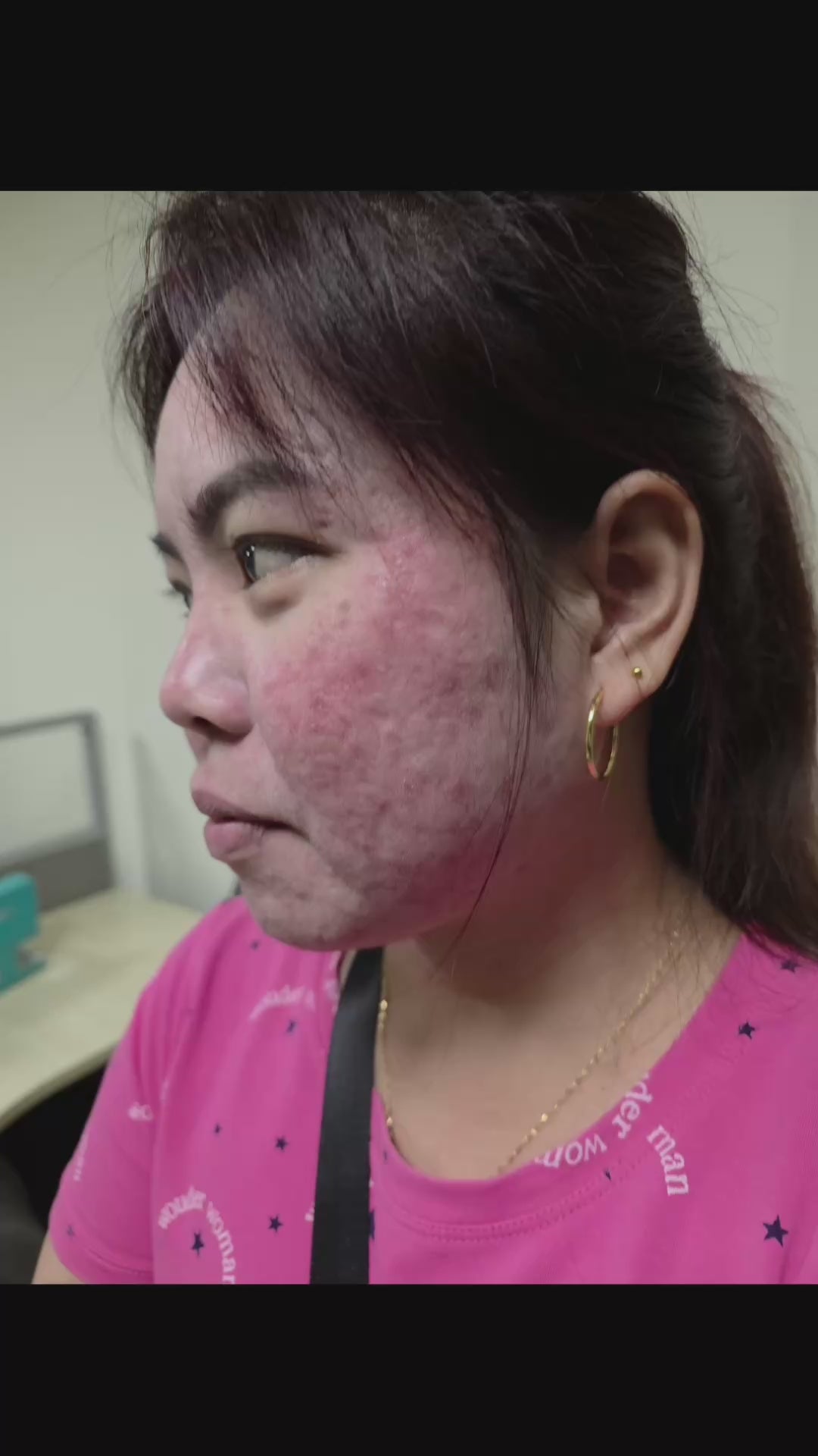 Load video: Testimonial from a client on the progress of her treatment.
